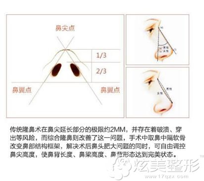 华美鼻综合整形美丽不止高度 华美鼻综合整形美丽不止高度