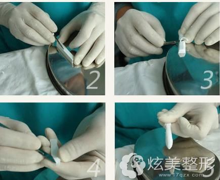 鼻部雕刻技艺 鼻部雕刻技艺