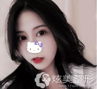 Ҧ����Ժ���轺������°�����һ��