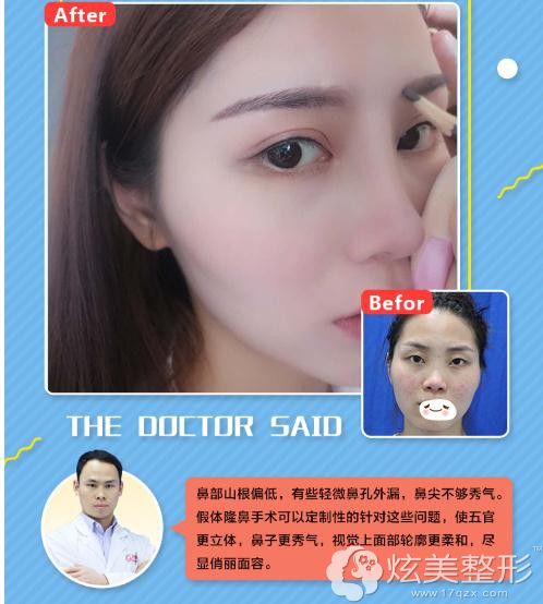 南昌时光鼻综合 南昌时光鼻综合