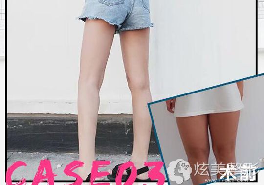 ��־��Ժ����������֬������Ա�