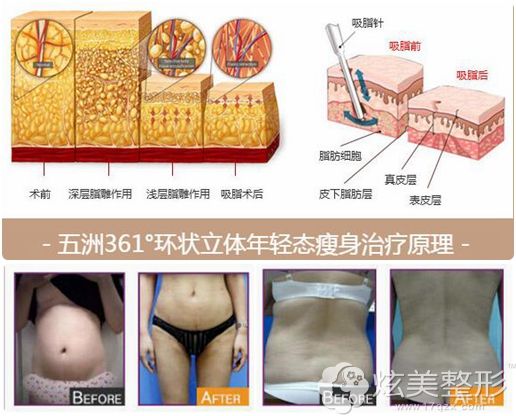 �����Ժ���Ƽ�361�㻷״������֬����<span style=