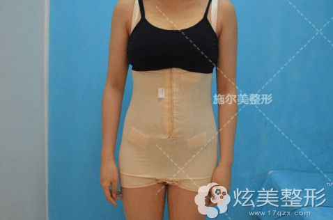 在南京施尔美做腰腹环吸后穿塑身衣 在南京施尔美做腰腹环吸后穿塑身衣