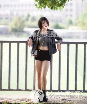 在南京施尔美做吸脂半年后恢复自然 在南京施尔美做吸脂半年后恢复自然