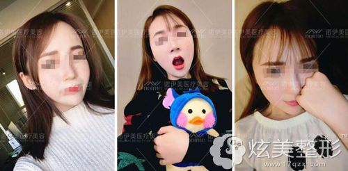 ֣��Ժ��������֬������ͷ����Ч��