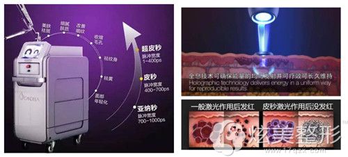 伊美尔国宾整形医院采用超皮秒祛斑 伊美尔国宾整形医院采用超皮秒祛斑