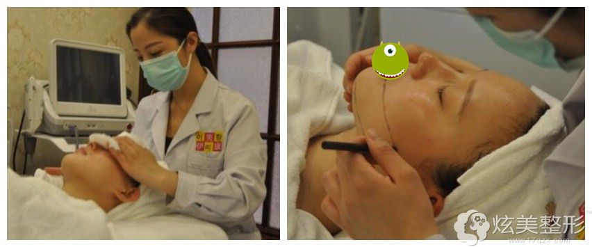 术前设计方案 术前设计方案