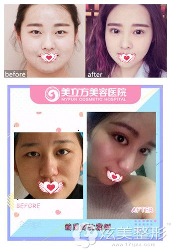 ��ݸ��������˫��Ƥ��������