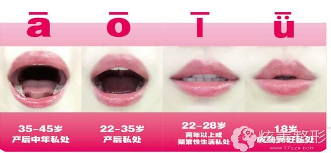 ����Ů��˽�������ļҺ�?����318������ҵ�ľ��ۻ��︾��