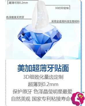 美加超薄牙贴面 美加超薄牙贴面