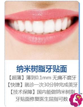 纳米树脂牙贴面 纳米树脂牙贴面