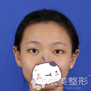 ��������������֬�����ͷ�ñ����ھ��������