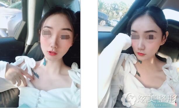 �沿������������һ��