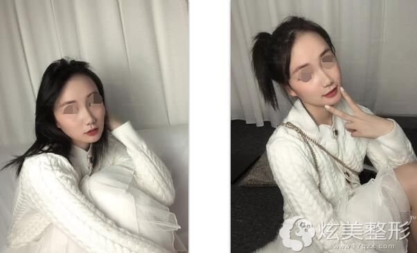 �ϼ�沿������������ָ�һ����