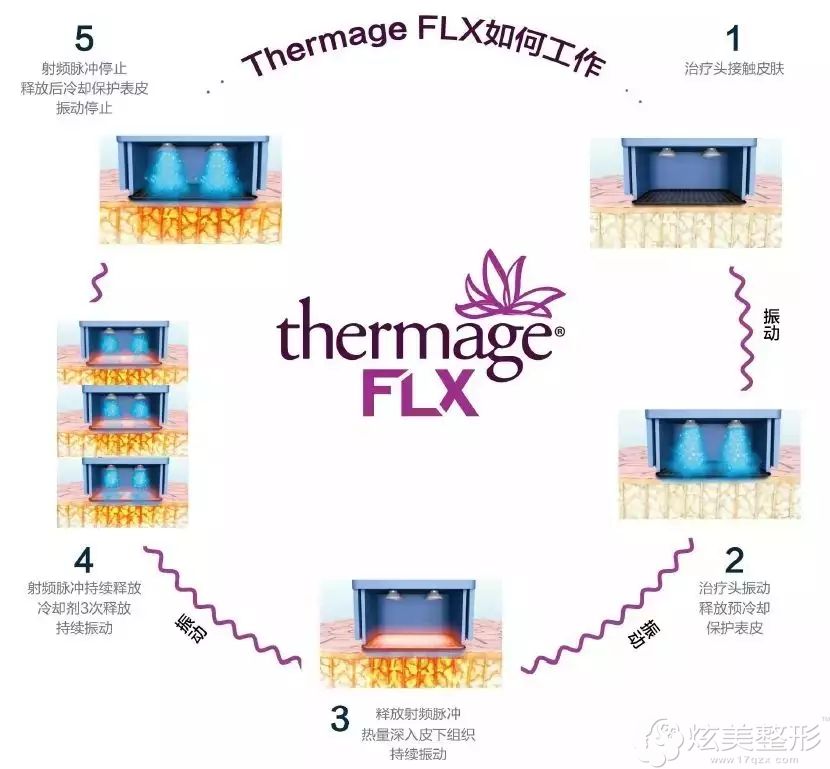 FLX重新改良震动模式,精准计算每一发能量更安全 FLX重新改良震动模式,精准计算每一发能量更安全