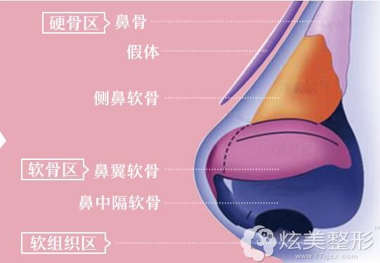 曾凡志医生分享爱思特芭比三体真鼻“三位一体”的设计原理 曾凡志医生分享爱思特芭比三体真鼻“三位一体”的设计原理