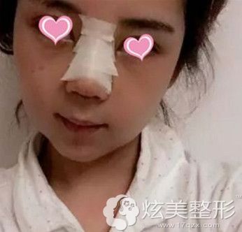 手术恢复期的煎熬等待 手术恢复期的煎熬等待