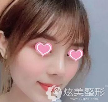 手术恢复后的喜悦 手术恢复后的喜悦