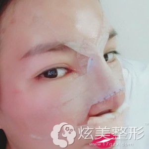 �Ʒ���ҽ��������¡�����󼴿�