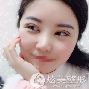 ���ͺ��ػ�����ȫ��˫��Ƥǰ����4��
