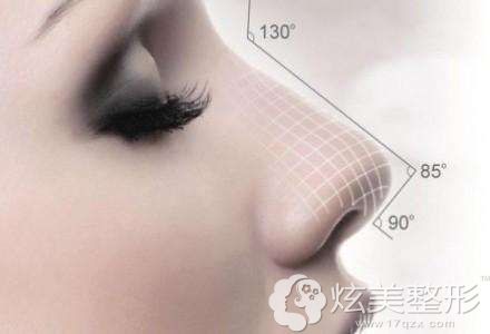 假体隆鼻术后鼻子标准 假体隆鼻术后鼻子标准