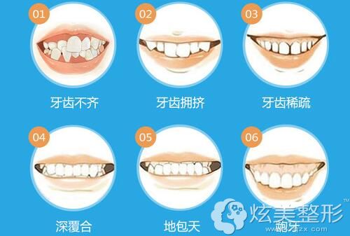 广州圣贝分享儿童牙齿矫正什么年龄做合适并公布优惠价格