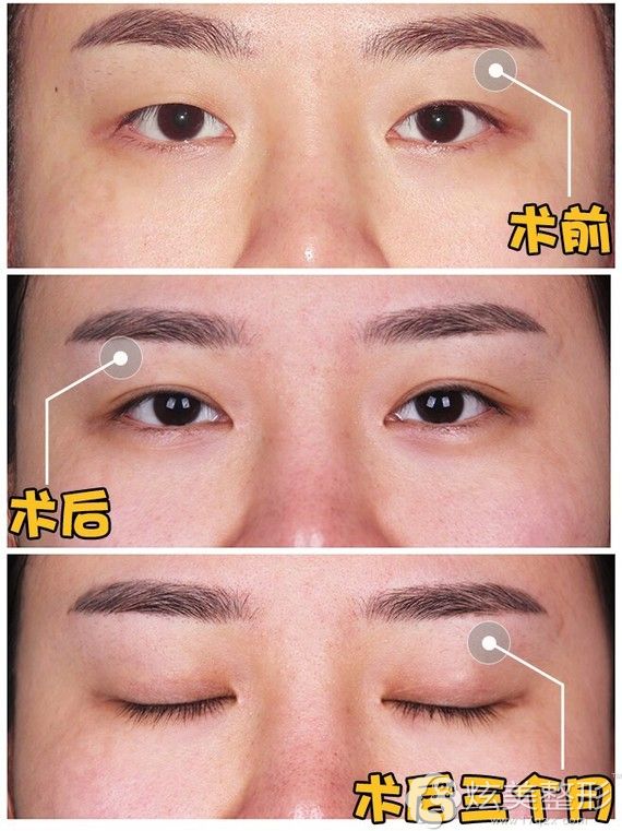 张军辉 益阳格莱美案例 张军辉 益阳格莱美案例