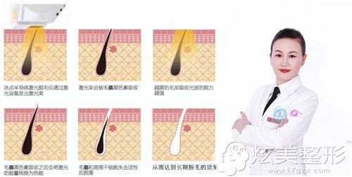 南京华美宋茂芹主任做冰点脱毛手术原理 南京华美宋茂芹主任做冰点脱毛手术原理