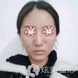 ����Ժ�������������������󼴿�Ч��