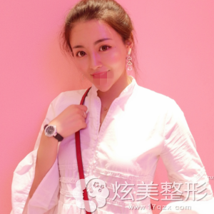 广州画美牟北平鼻综合手术后7天 广州画美牟北平鼻综合手术后7天