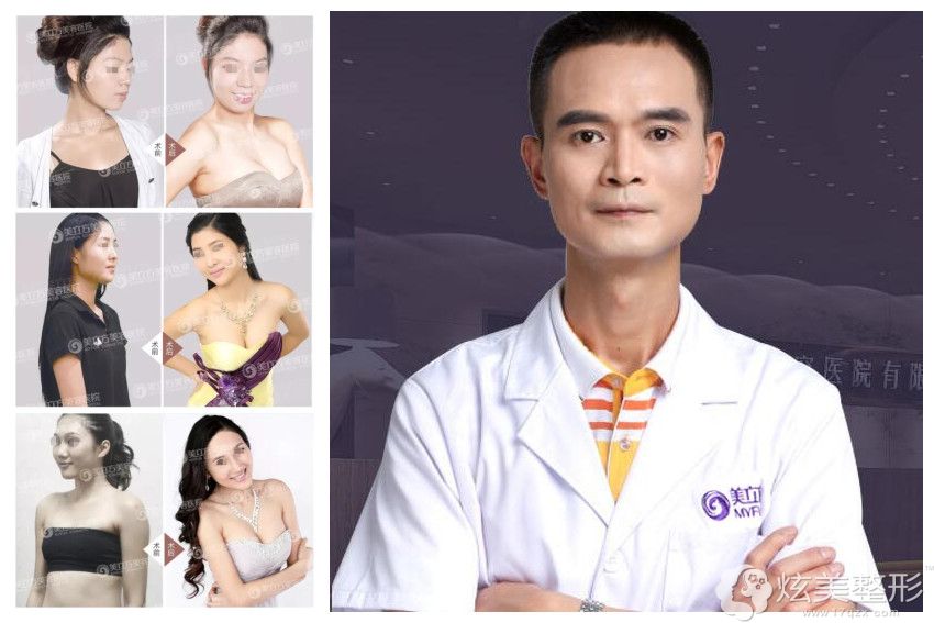 隆胸医生李志刚及案例分享 隆胸医生李志刚及案例分享