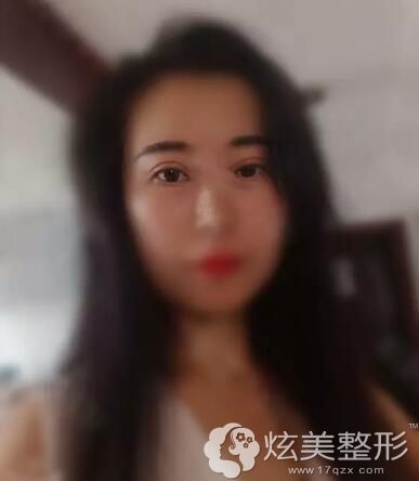��������˫��Ƥһֱ���׻ָ�