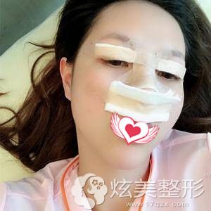 ��������ҽ��̷����Ϊ�Ҹ������۱��������������͸�
