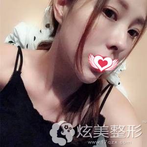 ̷����ҽ��Ϊ�����۱���������18���Ѿ�����