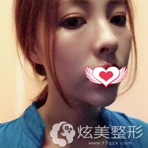 �������������۱��ۺ�����1���»����ָ�