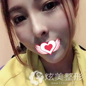 ̷����ҽ��Ϊ�����۱��ۺ�����2���»ָ���Ȼ