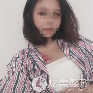 贵阳美贝尔宋俊辉假体丰胸当天 贵阳美贝尔宋俊辉假体丰胸当天