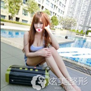 在柳州华美做自体脂肪丰胸术后3个月恢复自然 在柳州华美做自体脂肪丰胸术后3个月恢复自然
