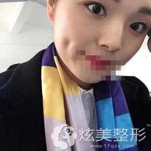 ����ޱ������֬�����100��