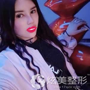 ����������ҽ���ŷ�Ϊ�����۱��ۺϺ�֬���������15����������