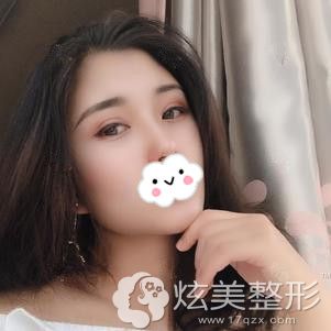 ������������˫��Ƥ����1���»ָ���Ȼ