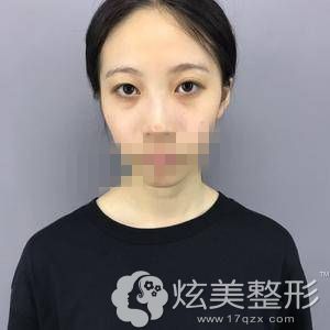 �����ݻ�������ȫ��˫��Ƥ+���۽Ǻ� ����������������