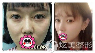 �ɶ��������۲����尸��