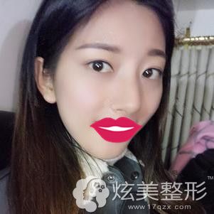 �ֺ���ҽ��Ϊ����������������һ�ܸ����沿�ɳ�Ч������