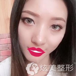 �ֺ���ҽ��Ϊ����������������18���沿���±���
