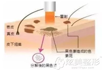 �Ż݊�ҽ�����������ԭ��