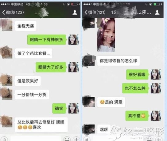 找卢开锐院长做双眼皮术后一致好评 找卢开锐院长做双眼皮术后一致好评