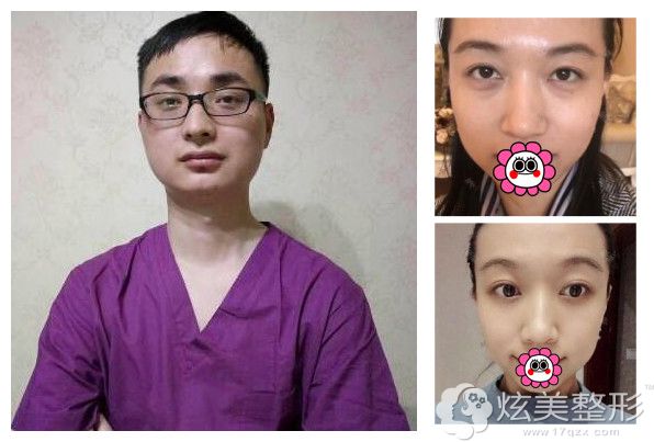 孝感天妃医疗美容门诊部柳肖医生及祛眼袋案例 孝感天妃医疗美容门诊部柳肖医生及祛眼袋案例