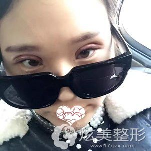 ������������ҽ��Ϊ�������ۺ�����3����۾�����