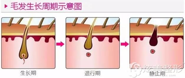 从毛发生长周期来看秋季脱毛刚刚好 从毛发生长周期来看秋季脱毛刚刚好